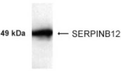 Western Blot: SERPINB12 AntibodyBSA Free [NB100-93572]