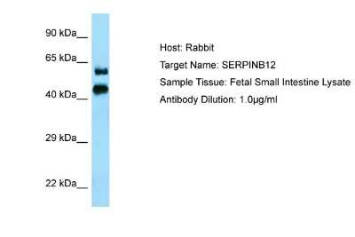 Western Blot: SERPINB12 Antibody [NBP1-98386]