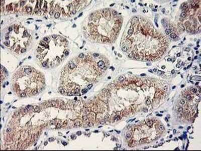 Immunohistochemistry-Paraffin: SERPINB13 Antibody (OTI2B6) [NBP2-01312]