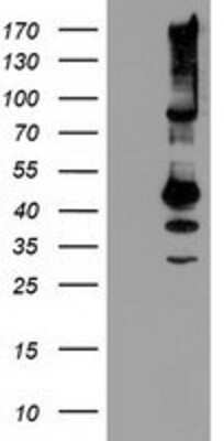 Western Blot: SERPINB13 Antibody (OTI2B6) [NBP2-01312]