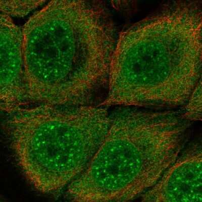 Immunocytochemistry/ Immunofluorescence: SERPINB13 Antibody [NBP2-57225]