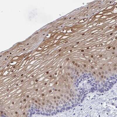 Immunohistochemistry: SERPINB13 Antibody [NBP2-38821]
