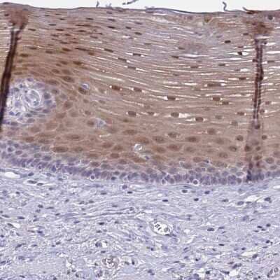 Immunohistochemistry-Paraffin: SERPINB13 Antibody [NBP2-38821]