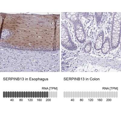 Immunohistochemistry-Paraffin: SERPINB13 Antibody [NBP2-38821]