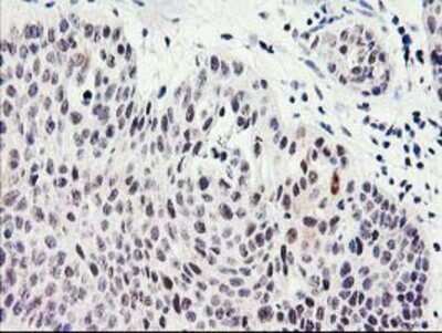 Immunohistochemistry: SERPINB13 Antibody (OTI2B6) - Azide and BSA Free [NBP2-74126]