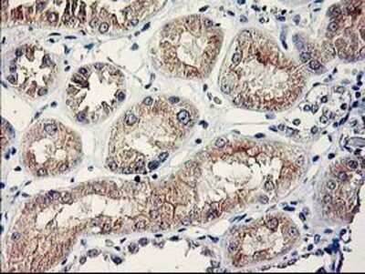 Immunohistochemistry: SERPINB13 Antibody (OTI2B6) - Azide and BSA Free [NBP2-74126]