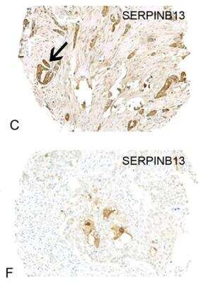 Immunohistochemistry: SERPINB13 Antibody (OTI2B6) [NBP2-01312]
