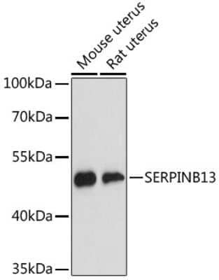 Western Blot: SERPINB13 AntibodyAzide and BSA Free [NBP2-94638]