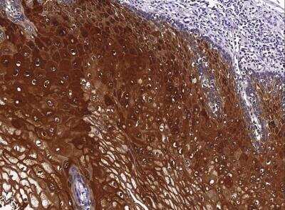 Immunohistochemistry-Paraffin: SERPINB4 Antibody (001) [NBP2-90154]