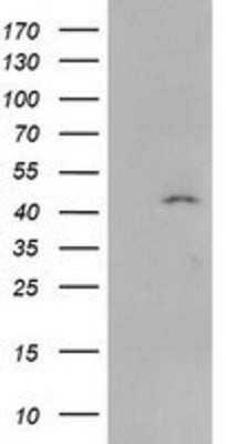 Western Blot: SERPINB4 Antibody (OTI4C8) [NBP2-03595]