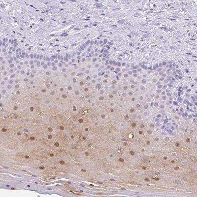 Immunohistochemistry: SERPINB4 Antibody [NBP2-46762]