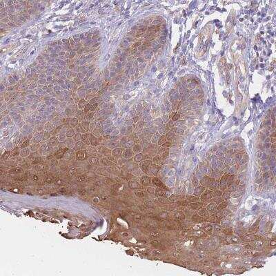 Immunohistochemistry: SERPINB4 Antibody [NBP2-46779]