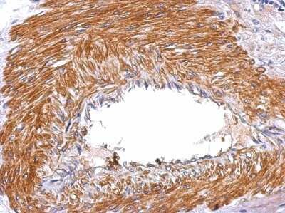 Immunohistochemistry-Paraffin: Serpin E2/PN1 Antibody [NBP2-20315]