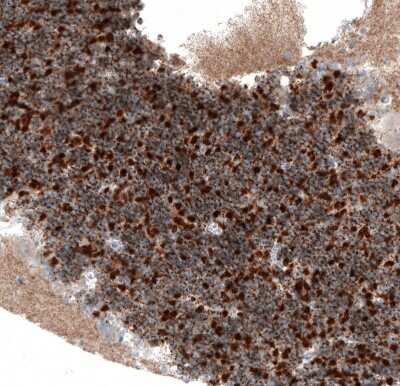 Immunohistochemistry-Paraffin: SERPINE3 Antibody [NBP2-14751]