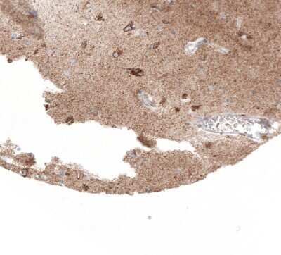 Immunohistochemistry-Paraffin: SERPINE3 Antibody [NBP2-14751]