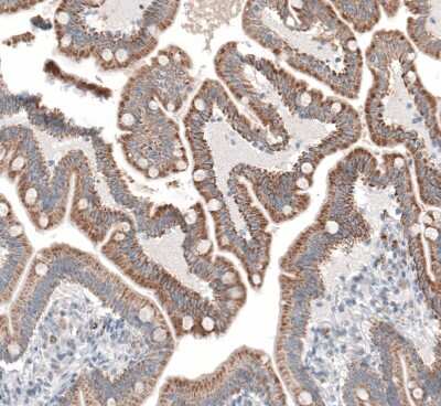 Immunohistochemistry-Paraffin: SERPINE3 Antibody [NBP2-14751]