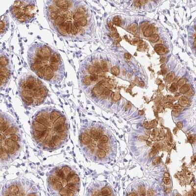 Immunohistochemistry-Paraffin: SERPINE3 Antibody [NBP2-34209]