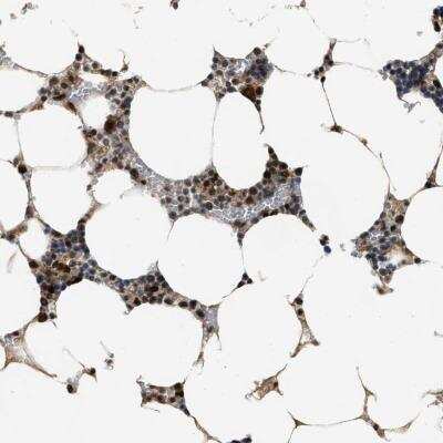 Immunohistochemistry: SERTAD2 Antibody [NBP1-81541]