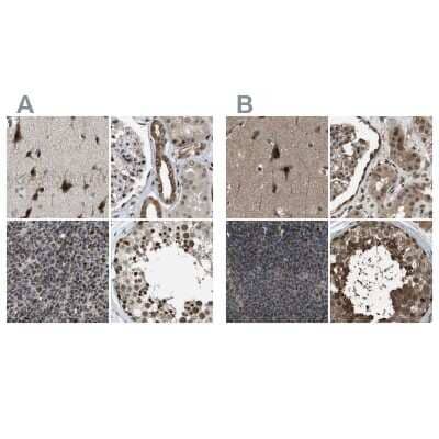 Immunohistochemistry-Paraffin: SERTAD2 Antibody [NBP1-81541]