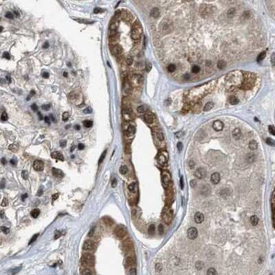 Immunohistochemistry-Paraffin: SERTAD2 Antibody [NBP1-81541]