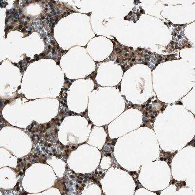 Immunohistochemistry-Paraffin: SERTAD2 Antibody [NBP1-81542]