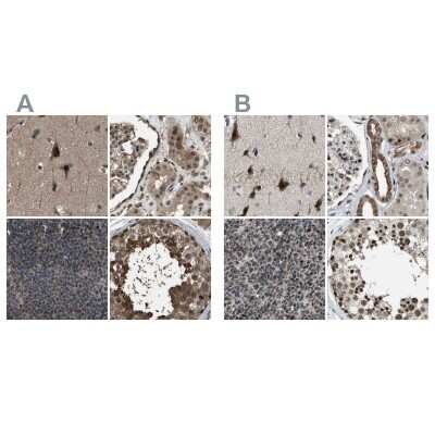Immunohistochemistry-Paraffin: SERTAD2 Antibody [NBP1-81542]