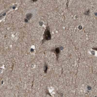 Immunohistochemistry-Paraffin: SERTAD2 Antibody [NBP1-81542]