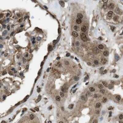 Immunohistochemistry-Paraffin: SERTAD2 Antibody [NBP1-81542]