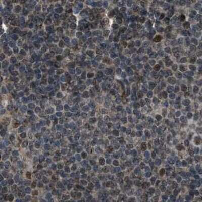 Immunohistochemistry-Paraffin: SERTAD2 Antibody [NBP1-81542]