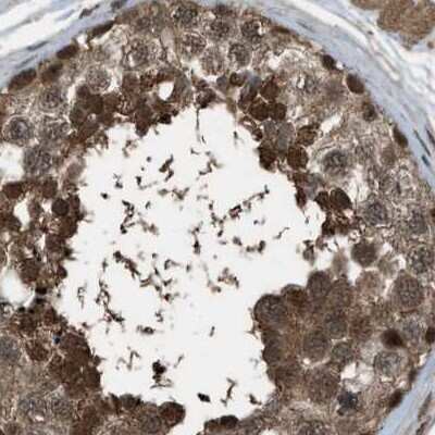 Immunohistochemistry-Paraffin: SERTAD2 Antibody [NBP1-81542]