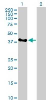 Western Blot: SERTAD2 Antibody [H00009792-B01P]