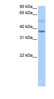 Western Blot: SERTAD2 Antibody [NBP1-79455]