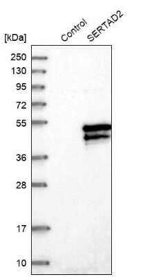 Western Blot: SERTAD2 Antibody [NBP1-81542]