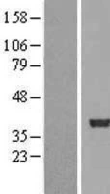 Western Blot: SERTAD2 Overexpression Lysate [NBL1-15860]