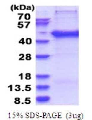 SDS-PAGE: Recombinant Human SERTAD2 His Protein [NBP2-51773]