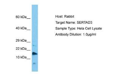 Western Blot: SERTAD3 Antibody [NBP2-83513]