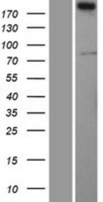 Western Blot: SERTAD3 Overexpression Lysate [NBL1-15861]