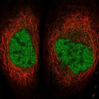 Immunocytochemistry/ Immunofluorescence: SERTAD4 Antibody [NBP1-84216]