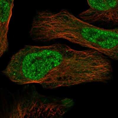 Immunocytochemistry/ Immunofluorescence: SERTAD4 Antibody [NBP1-84217]