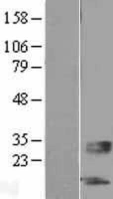 Western Blot: SERTM1 Overexpression Lysate [NBL1-08165]