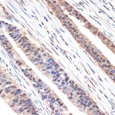 Immunohistochemistry-Paraffin: SESN1 Antibody (7I5Y4) [NBP3-15916]