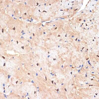 Immunohistochemistry-Paraffin: SESN1 Antibody (7I5Y4) [NBP3-15916]
