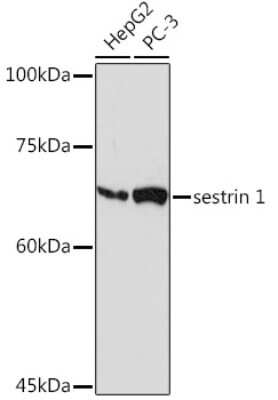 Western Blot: SESN1 Antibody (7I5Y4) [NBP3-15916]