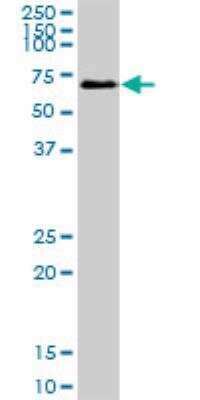 Western Blot: SESN1 Antibody [H00027244-B01P]