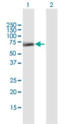 Western Blot: SESN1 Antibody [H00027244-B01P]