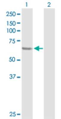 Western Blot: SESN1 Antibody [H00027244-D01P]