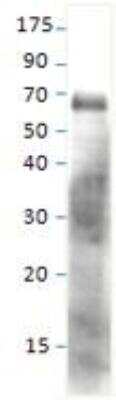 Western Blot: SESN1 Antibody [NBP1-44993]