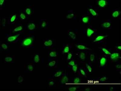 Immunocytochemistry/ Immunofluorescence: SESN2 Antibody (3B8) [H00083667-M03]
