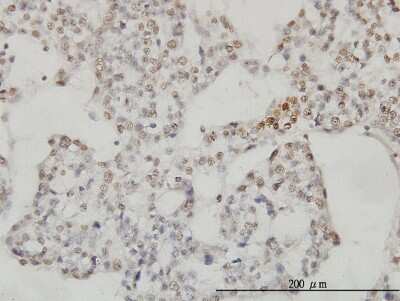 Immunohistochemistry-Paraffin: SESN2 Antibody (3B8) [H00083667-M03]