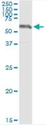 Immunoprecipitation: SESN2 Antibody (3B8) [H00083667-M03]